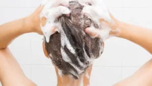 Her insanda görülen, çeşitli faktörlerden dolayı meydana gelen saç dökülmesi