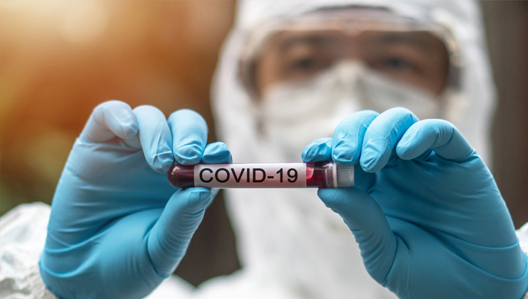 Korona Tazminat Başvurusu e-Devlet üzerinden yapılabilir mi? Covid aşısına Türkiye’de