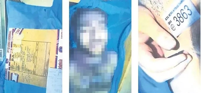 Cem Garipoğlu’nun Otopsi Görüntüleri Ortaya Çıktı