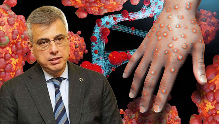 Sağlık Bakanı açıkladı: Türkiye'de 'Maymun Çiçeği' görüldü mü?