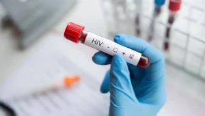 İzmir İl Sağlık Müdürlüğü, HIV sebebiyle vefat eden 13 yaşındaki