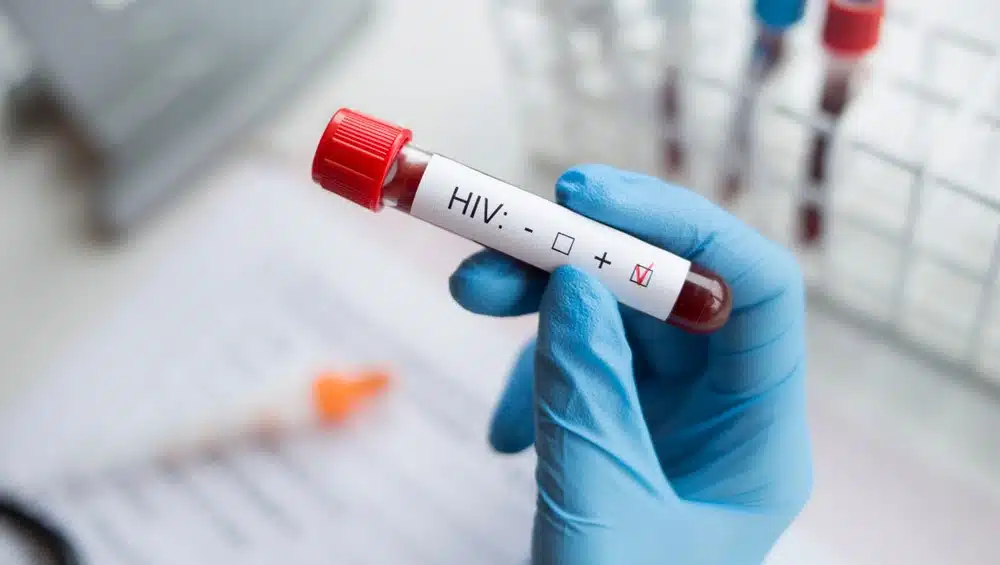 İzmir İl Sağlık Müdürlüğü, HIV sebebiyle vefat eden 13 yaşındaki