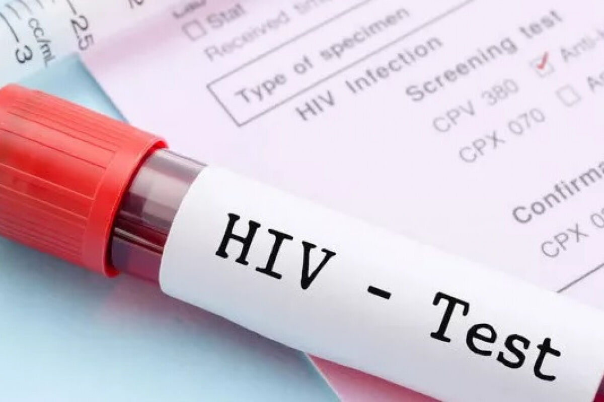 İHA-HIV Virüsü Nedir? Tedavi Yolları Nelerdir?
