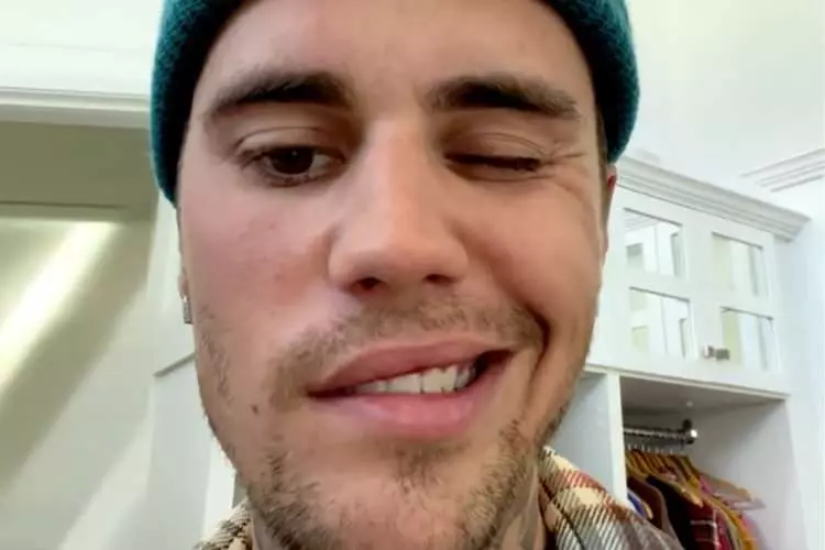 Justin Bieber'ın Geçirdiği Ramsay Hunt Sendromu Nedir? Ramsay Hunt Sendromu Belirtileri Nelerdir, Nasıl Tedavi Edilir?