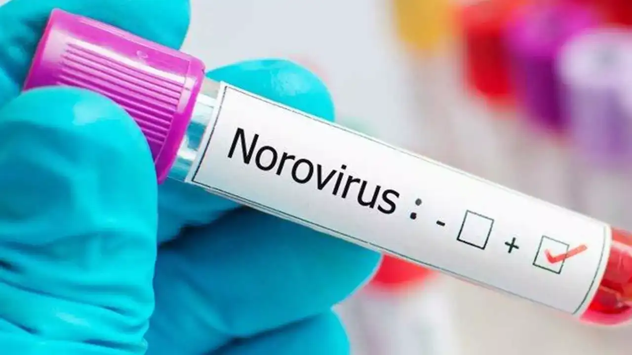 Norovirüs nedir