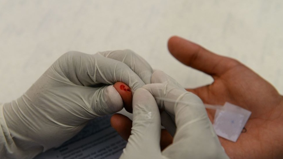 AIDS'li bir hasta ne kadar yaşar? HIV tamamen iyileşir mi,