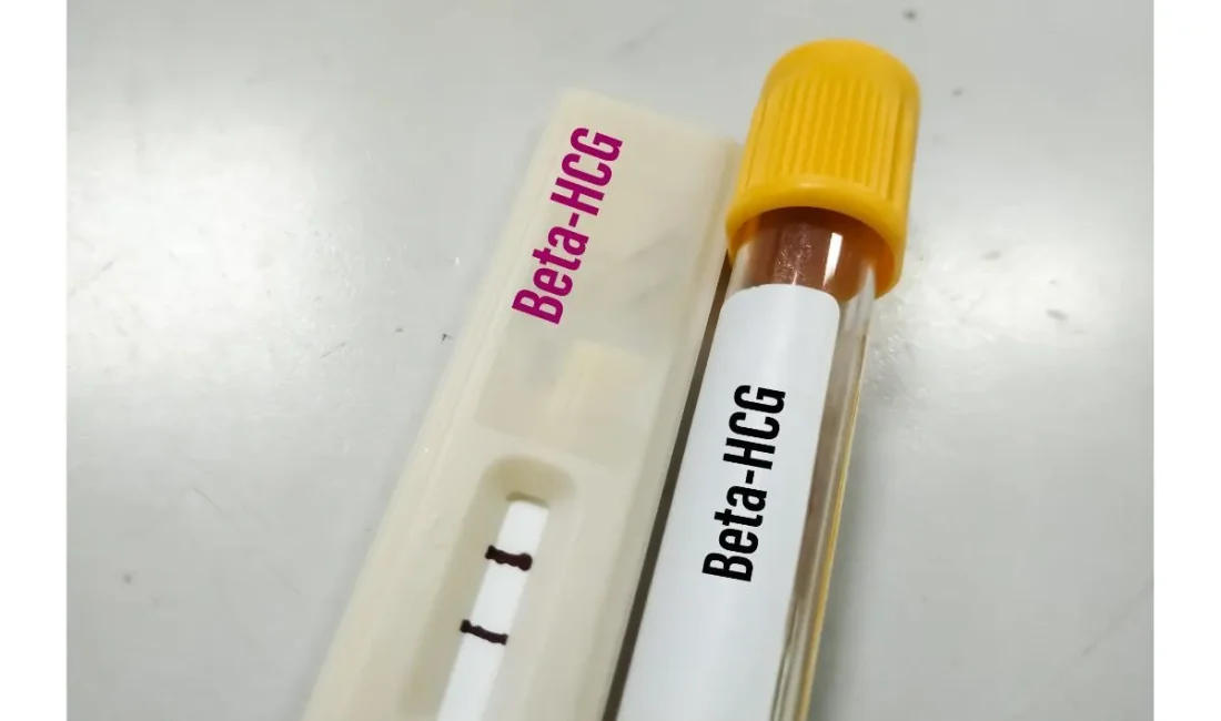Beta HCG nedir? Gebelikte Beta HCG değerleri nasıl olmalı? Düşük