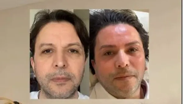 Nihat Doğan'ın Estetik Değişimi Sosyal Medyada Gündem Oldu