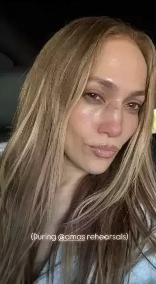 Jennifer Lopez, 2025 Amerikan Müzik Ödülleri'nin hazırlıkları sırasında yüzünden yaralandı.