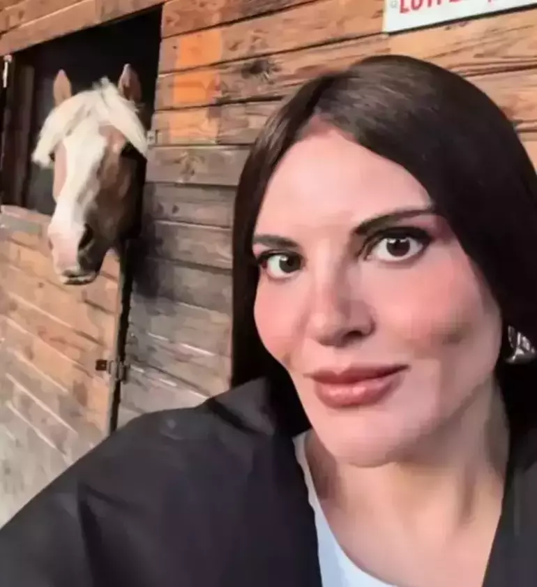 Görenler Şaştı Kaldı! Göksel’in Estetikli Yeni Hali Olay Yarattı