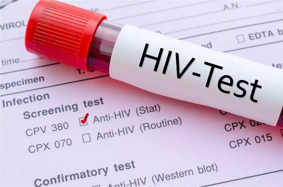HIV testi negatif ama belirti varsa ne anlama gelir? Pencere