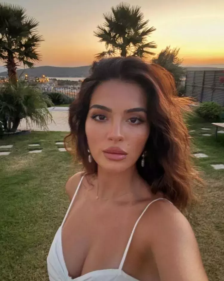 Melisa Aslı Pamuk’un Yeni Hali Sosyal Medyada Olay Oldu: Estetik mi Yaptırdı?