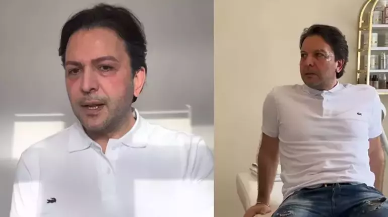 Nihat Doğan Estetikle Tanınmaz Hale Geldi! Yeni Yüzü Görenleri Şoke Etti