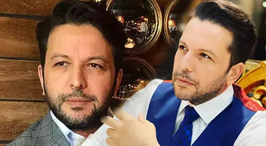 Nihat Doğan Estetikle Tanınmaz Hale Geldi! Yeni Yüzü Görenleri Şoke Etti