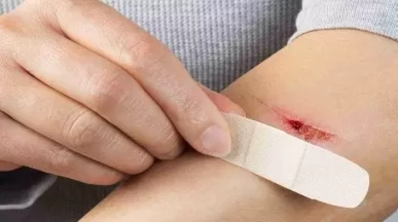 Yaraya Kolonya Dökülür mü? Açık Yarayı Temizlemek İçin Kolonya Kullanılır mı? Kolonya Yarayı Tahriş Eder mi?