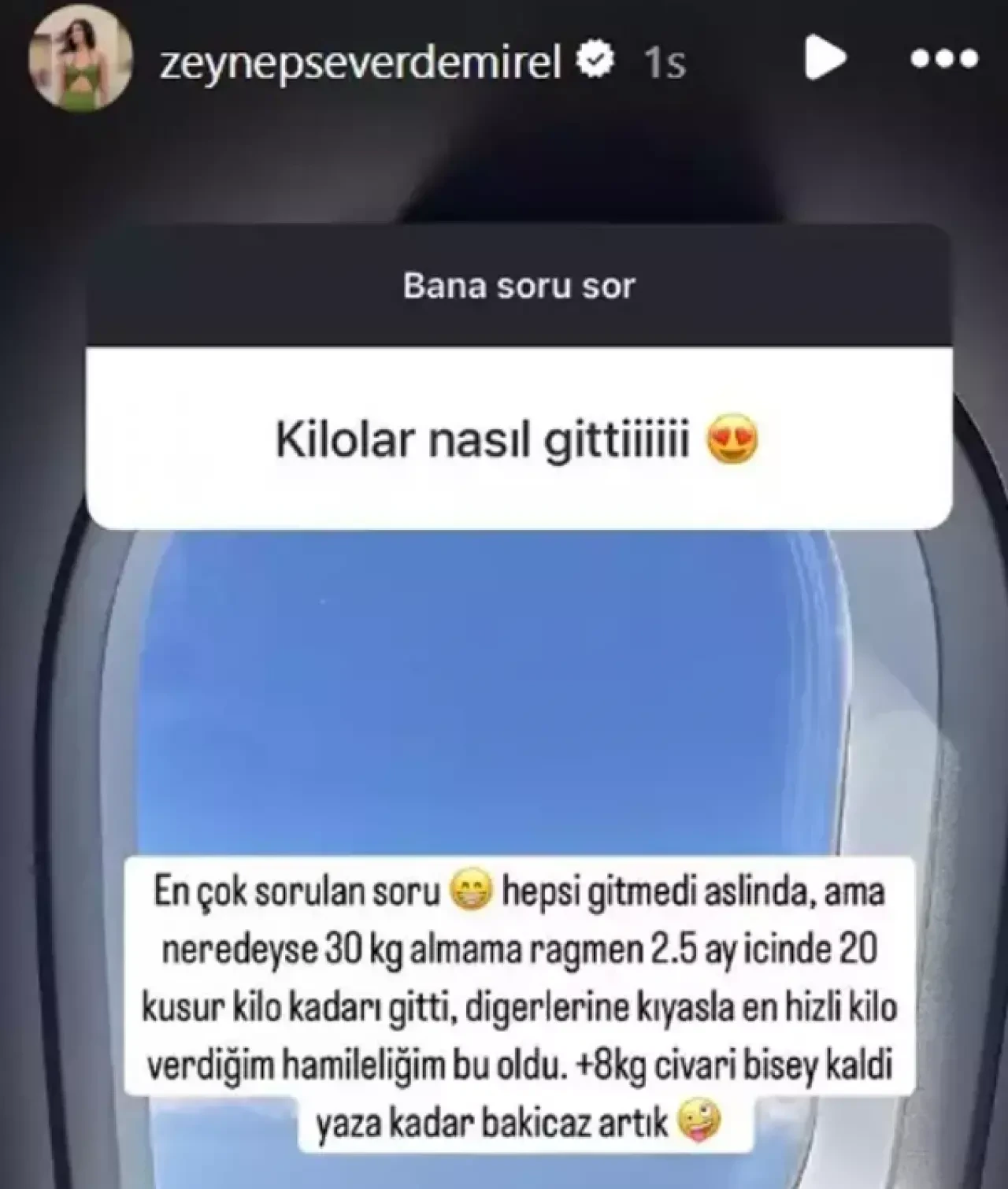 Volkan Demirel’in Eşi Zeynep Demirel 2.5 Ayda 20 Kilo Verdi: Korse Yok, ChatGPT Var!