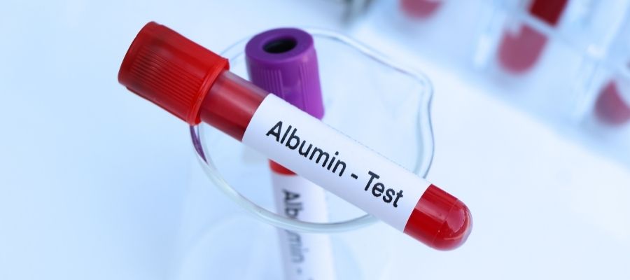 Albümin yüksekliği nedir, neden olur, hangi besinlerle düşer? Bu yazıda,