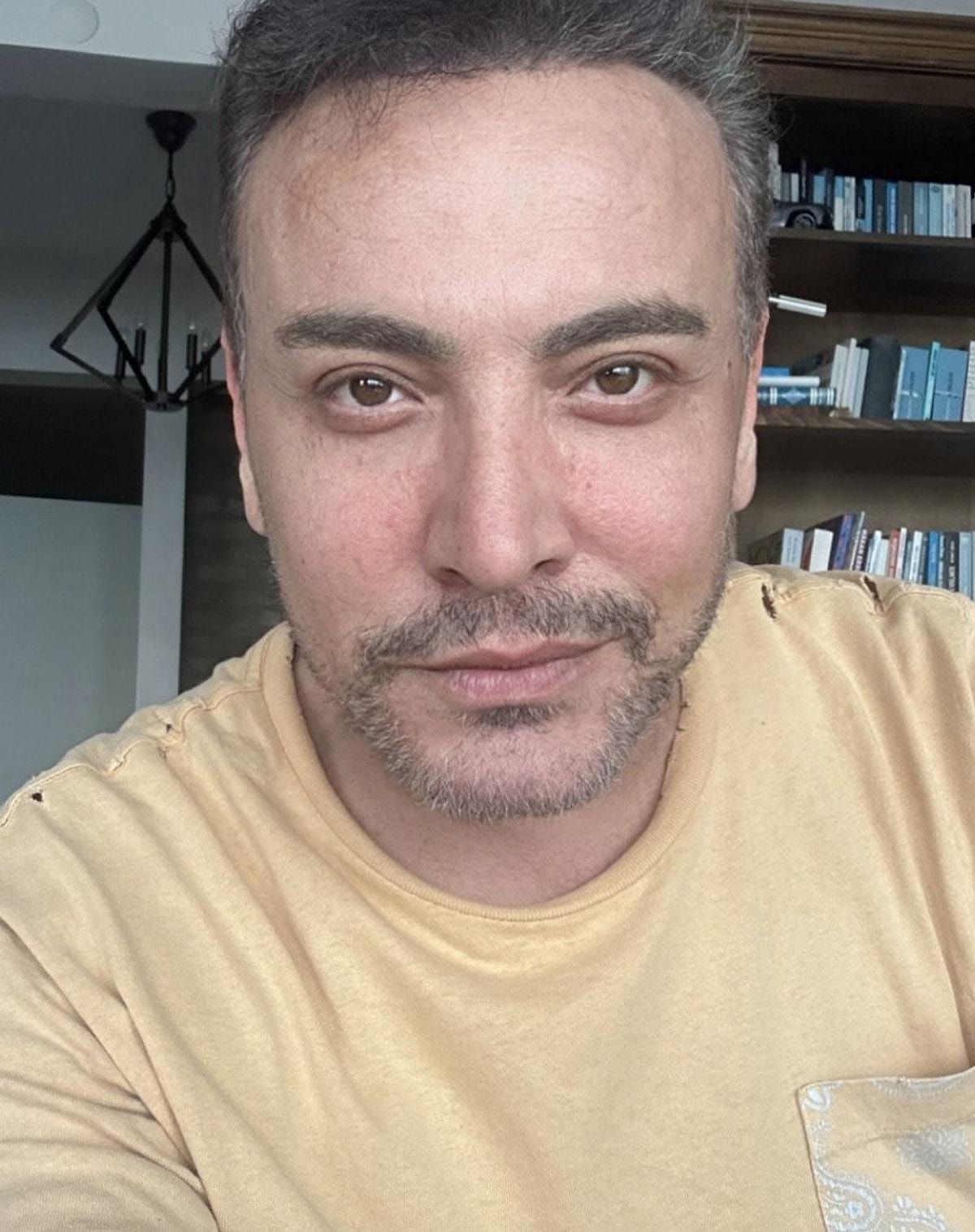Cenk Eren'in Gerçek Adı Yüksel Venedik mi? Cenk Eren Estetikli mi, Yüzüne Ne Yaptırdı?