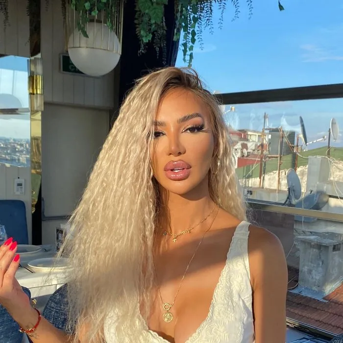 Didem Kınalı Kimdir, Kaç Yaşında, Nereli? Oryantal Dansçı mı, Şarkıcı mı Oldu? Estetikli ve Estetiksiz Fotoğrafları
