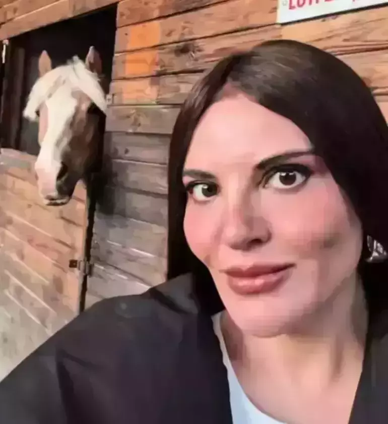 Estetik İddialarına Noktayı Koydu! Göksel: “Hayatımda Böyle Bir Şeyle Karşılaşmadım”