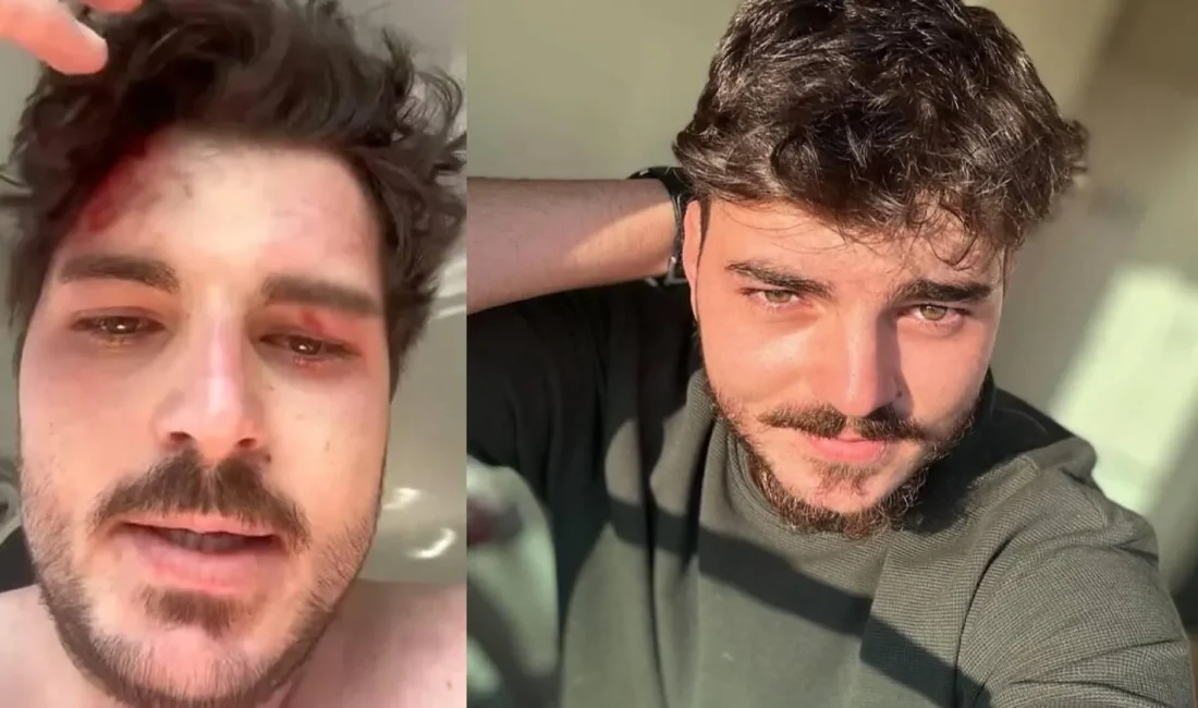 Mehmet Akif Akdeniz kimdir? İşte oyuncunun kariyeri ve trafikte uğradığı