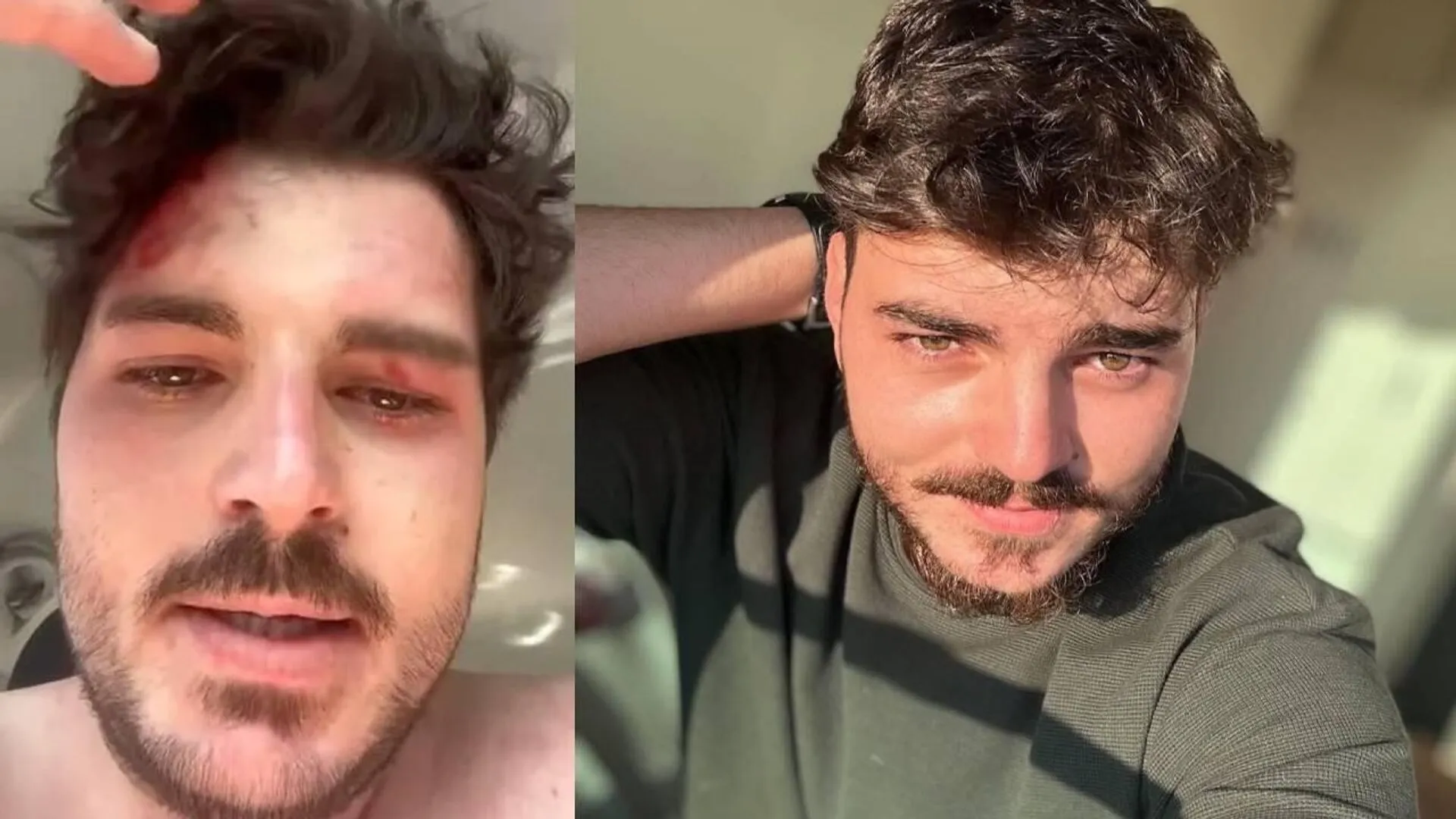 Mehmet Akif Akdeniz kimdir? İşte oyuncunun kariyeri ve trafikte uğradığı