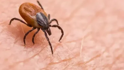 ABD başta olmak üzere dünya genelinde hızla yayılan alpha-gal sendromu,