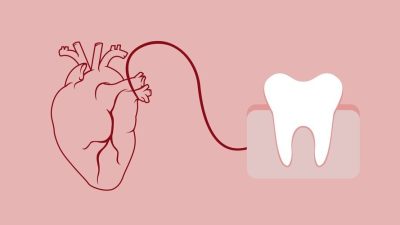 Harvard Üniversitesi tarafından 25 yıl süren kapsamlı bir araştırma, diş