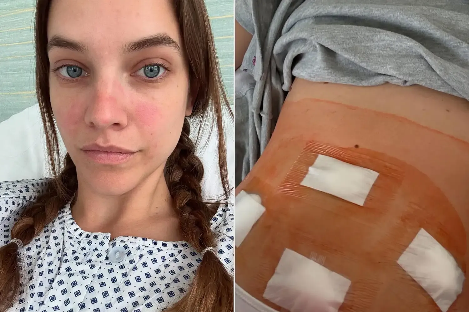 Barbara Palvin hastalığı nedir? Barbara Palvin Ameliyat mı oldu?