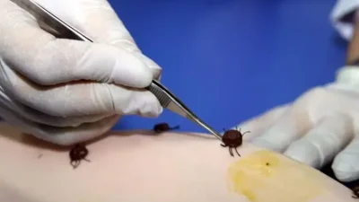 Dünya genelinde sivrisineklerden sonra insanlara en fazla hastalık bulaştıran kan