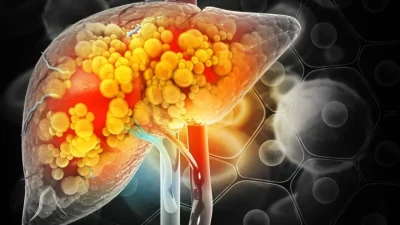 The Lancet dergisinde yayımlanan ve Dünya Kanser Gözlemevi verilerine dayanan