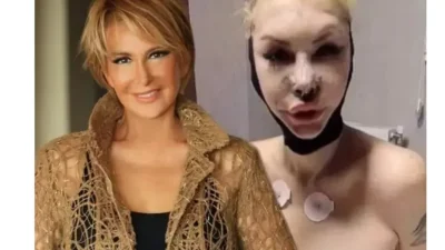 Seyhan Soylu ya da bilinen adıyla Sisi, estetik operasyonları, magazin