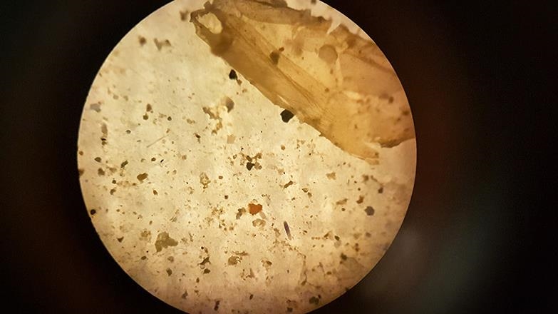 Fransa’da Toulouse Üniversitesi ile Fransız Ulusal Bilimsel Araştırma Merkezi (CNRS)