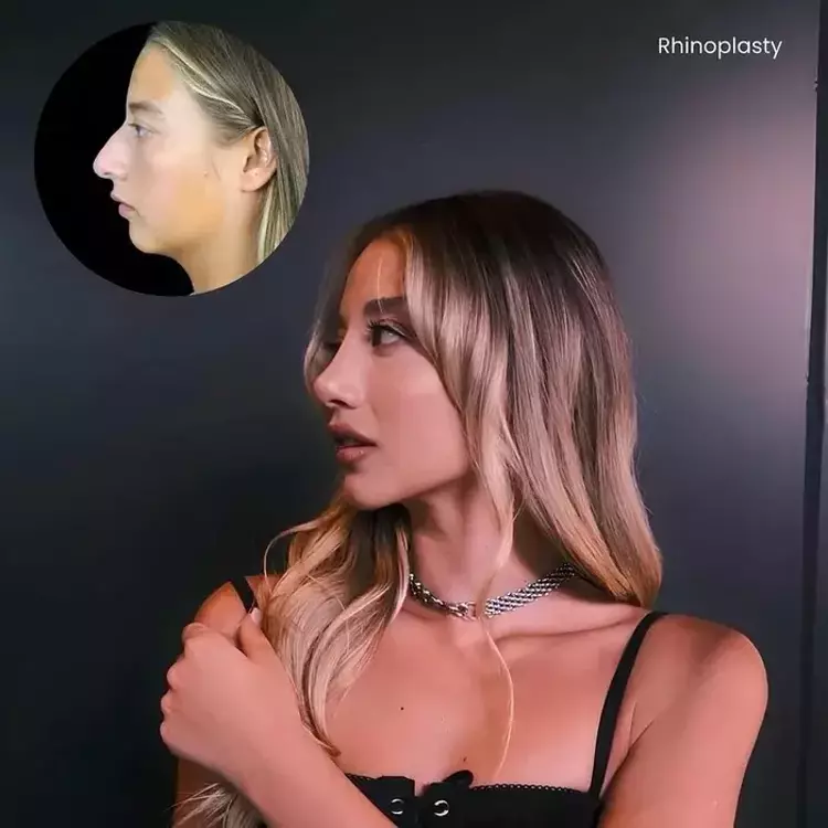 Survivor yıldızı Aleyna Kalaycıoğlu estetiksiz haliyle neden sosyal medyayı salladı