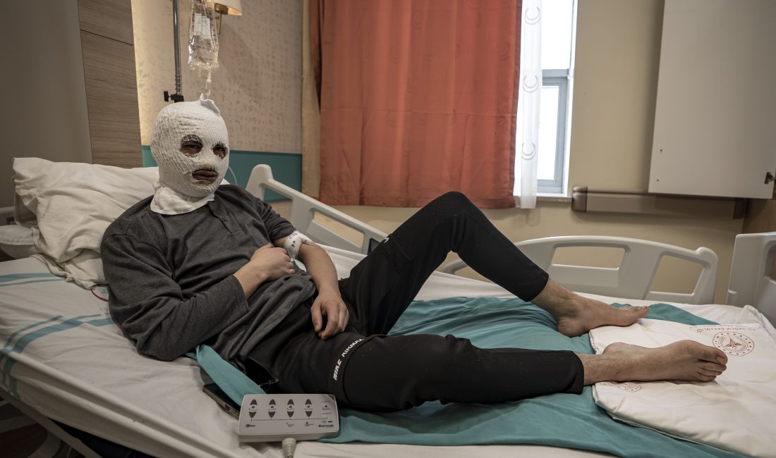 Erzurum’da çakmağını doldurmak istediği sırada sızan gazı fark edemeyen 19