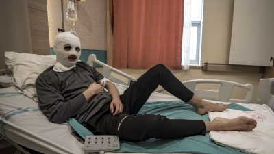 Erzurum’da çakmağını doldurmak istediği sırada sızan gazı fark edemeyen 19