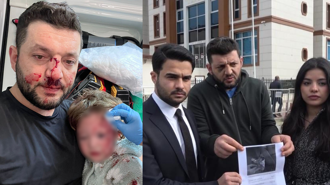 Yalova’nın Çınarcık ilçesine bağlı Esenköy beldesinde, kucağındaki 14 aylık kızıyla