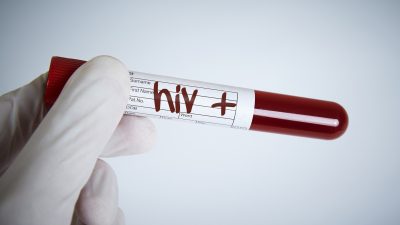Evlenmeden önce HIV pozitif olduğunu öğrenen ancak bu hayati durumu