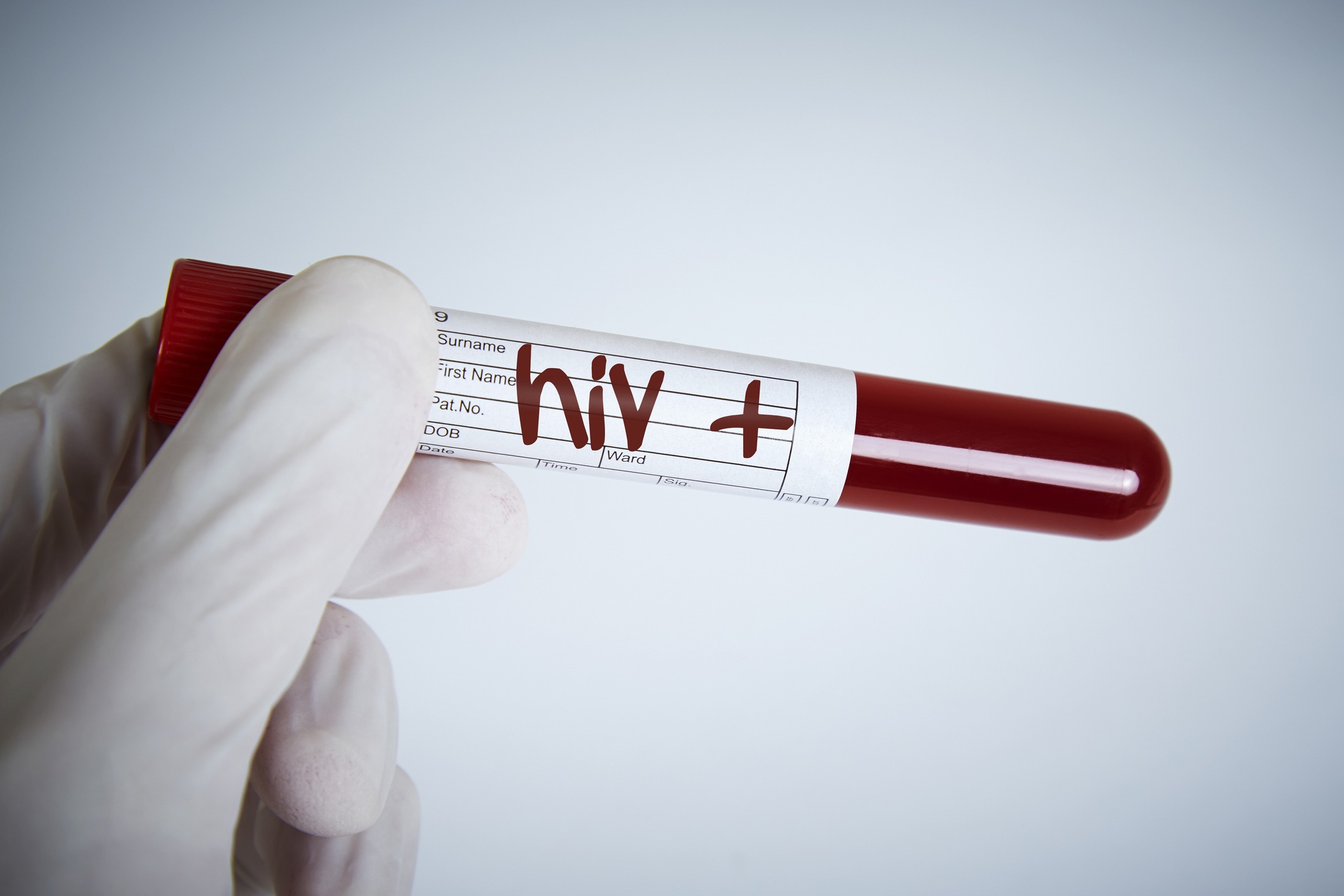 Evlenmeden önce HIV pozitif olduğunu öğrenen ancak bu hayati durumu
