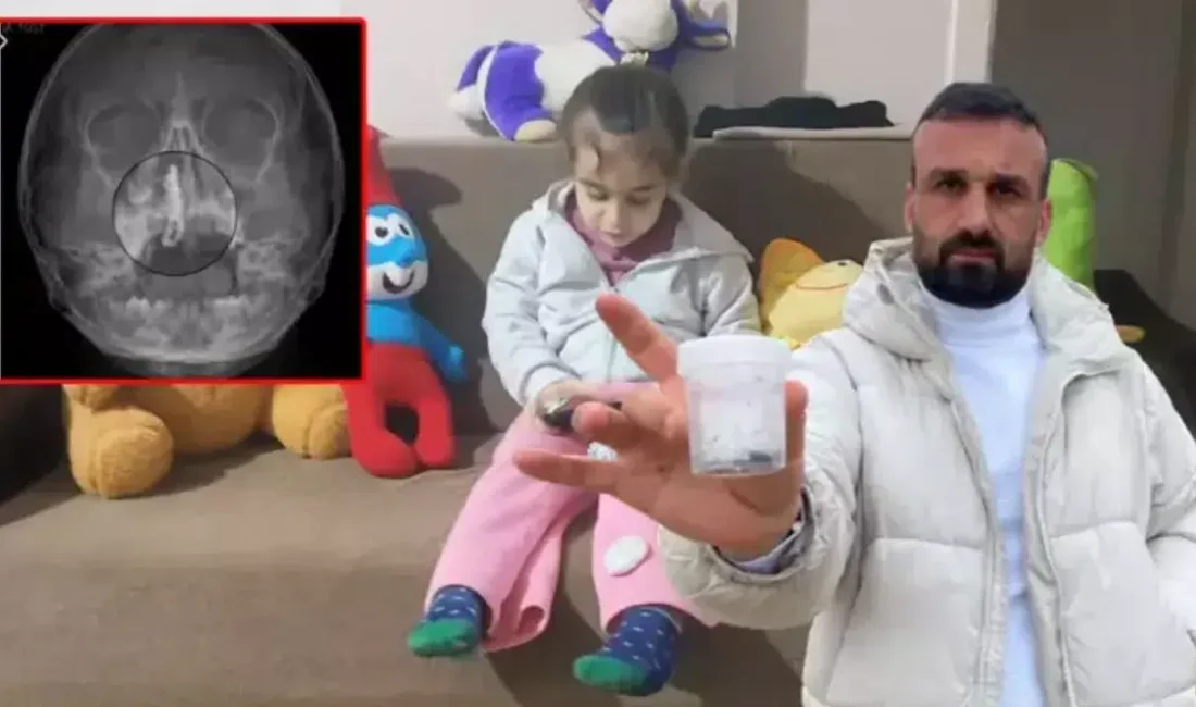 Rize’de şiddetli burun kanaması şikayetiyle hastaneye götürülen 5 yaşındaki Polen