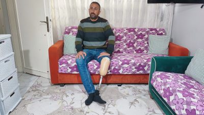 Adana’da bir kavgayı ayırmak isterken bacağını kaybeden ve protezle hayata