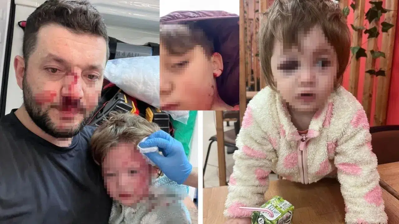 Yalova’nın Çınarcık ilçesinde kucağındaki bebeğiyle saldırıya uğrayan Muhammet Baca ve