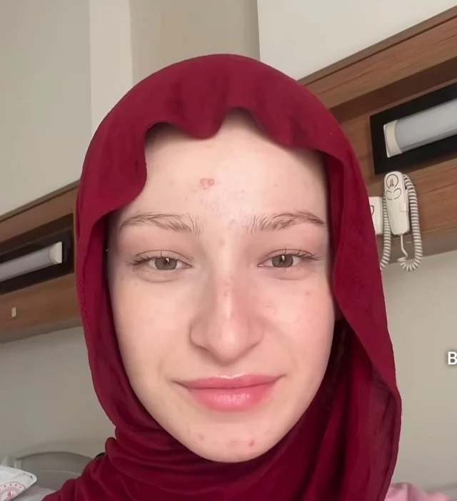 Fatma Soydaş'ın estetiksiz halini görenler neden bu kadar şaşırıyor