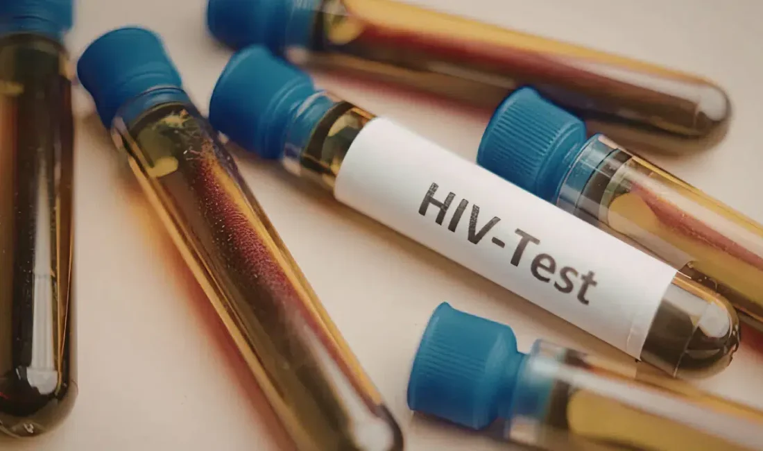 Türkiye son yıllarda dünya genelinde HIV vakalarının en hızlı artış