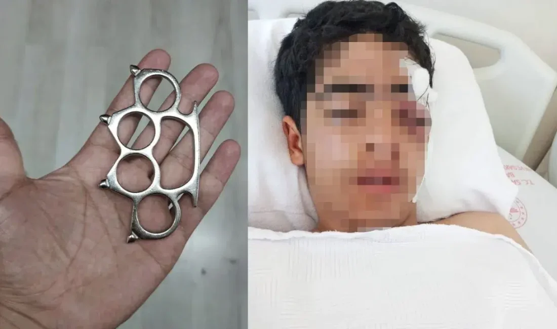 İstanbul Esenyurt’ta akranı tarafından acımasızca darbedilen 15 yaşındaki genç, hayatının