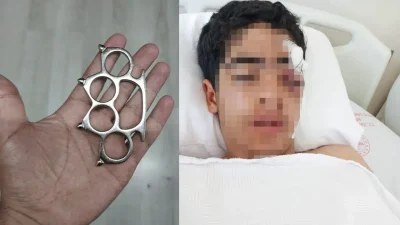 İstanbul Esenyurt’ta akranı tarafından acımasızca darbedilen 15 yaşındaki genç, hayatının