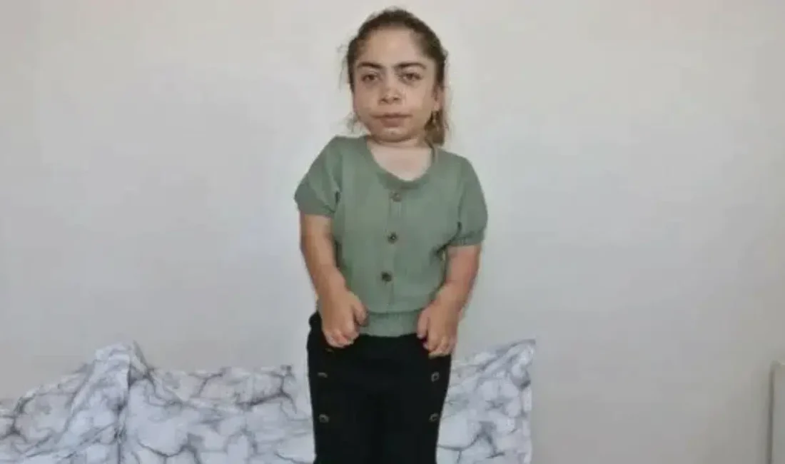 TikTok platformunda paylaştığı içeriklerle kısa sürede milyonların sevgisini kazanan Medine