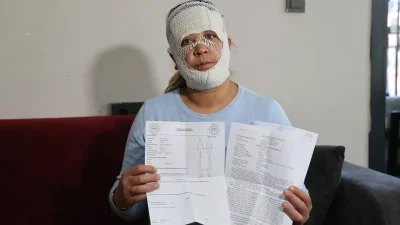 Adana’da “prenses cilt bakımı” yaptırmak için bir güzellik merkezine giden