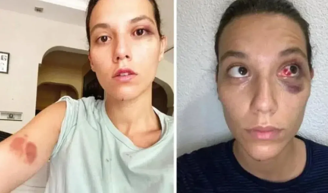 Türkiye gündemini uzun süre meşgul eden ve magazin dünyasında taşları