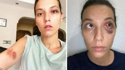 Türkiye gündemini uzun süre meşgul eden ve magazin dünyasında taşları